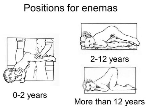 How to do an enema