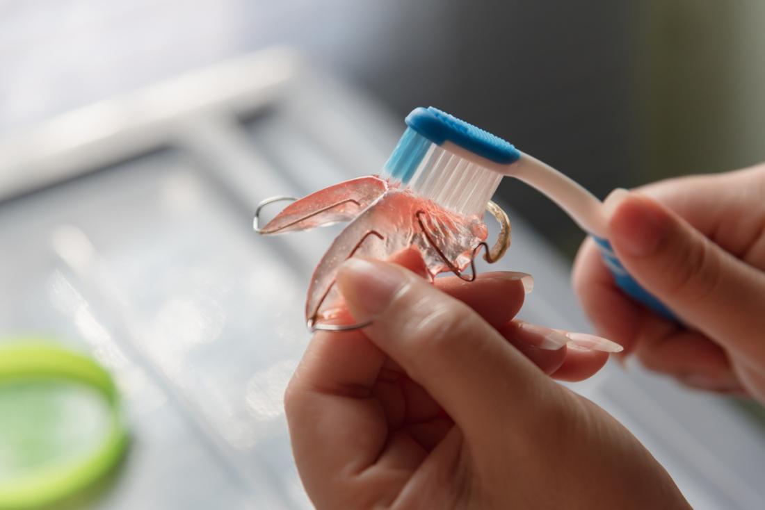 How to Properly Clean Your Retainer: 5 Effective Ways for a Fresh Smile in 2025