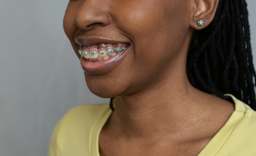 How to Properly Get Braces: A Step-by-Step Guide for 2025